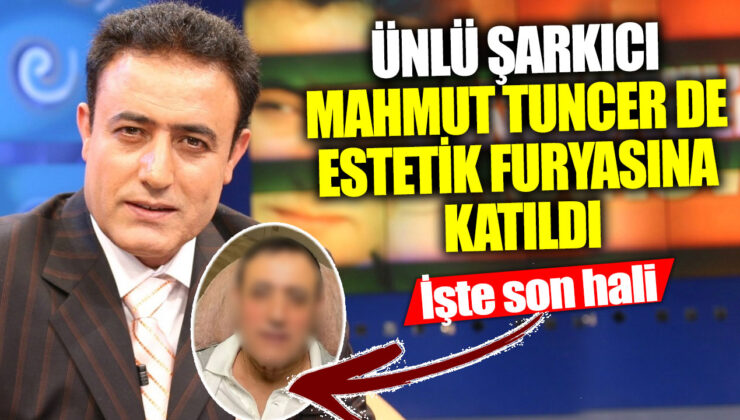 Ünlü Şarkıcıların Estetik Operasyon Çılgınlığı: Mahmut Tuncer’in Şok Edici Değişimi!